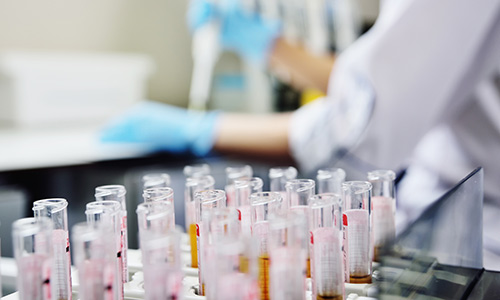 Genetic testing - test tubes lined up in laboratory with technician in the background