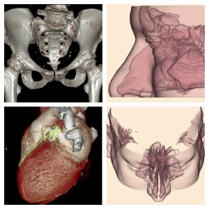 Private scans at Nuffield Health Leeds Hospital