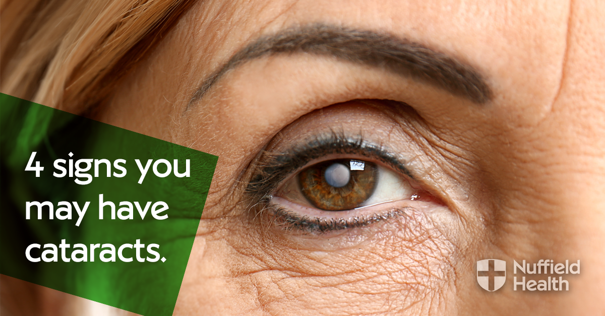 4 signs you may have cataracts Nuffield Health