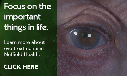 Click here to book your cataract treatment with Nuffield Health.
