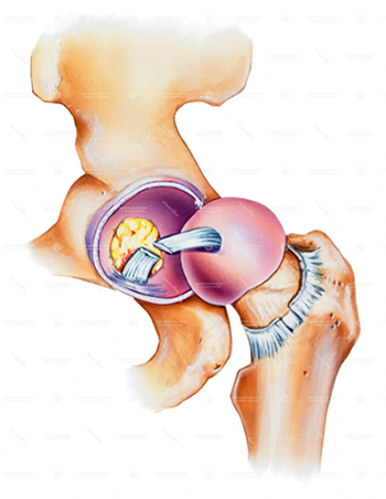 labrum; labral tear