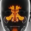 Sinus problems and treatments