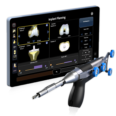 CORI® surgical system showing a screen with 3D knee implant planning and a handheld surgical tool with blue tracking markers.