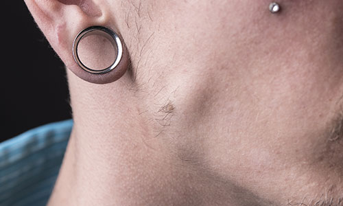 Stretched earlobe